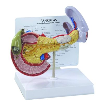 3B Scientific W33367 Bauchspeicheldrése Anatomie-Modell mit Pathologien