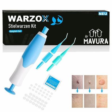 WARZOX Skin Tag Remover Kit Stielwarzen Set Fibrom Kosmetik Entferner 54tlg