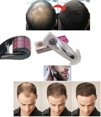 Microneedle Roller 0,50mm - für Bart & Haarwachstum