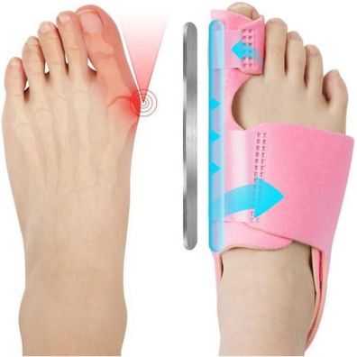 ACWOO Hallux Valgus Korrektur Schiene Set mit 2 Schienen und 2 Zehenspreizern