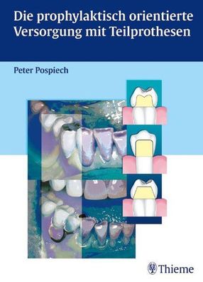 Die prophylaktisch orientierte Versorgung mit Teilprothesen, Peter Pospiech